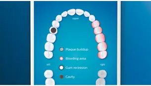 Philips Sonicare DiamondClean Smart 9500 Rechargeable Electric Power Toothbrush, Rose Gold (HX9924/61) 12 Philips DiamondClean Smart 9500 (HX9924/61) Sonicare Sonic electric toothbrush